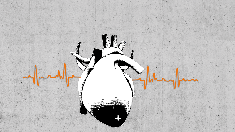 graphic